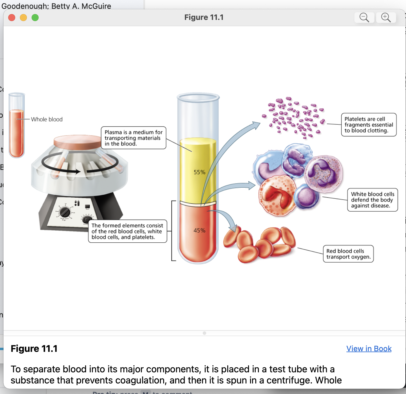 figure view screen with zoom
